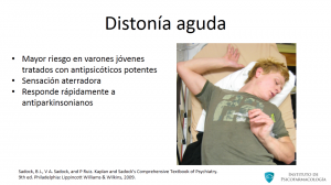 10-distonia-aguda